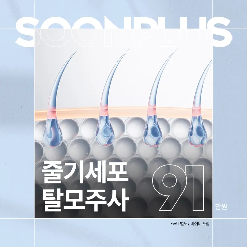 순플러스_줄기세포탈모주사