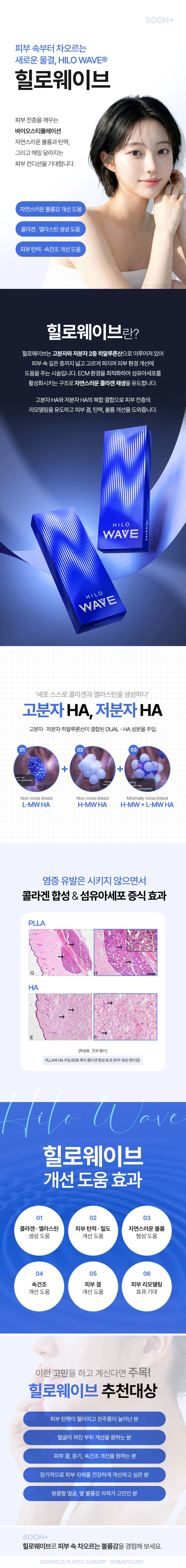 순플러스성형외과 순플러스_힐로웨이브 이벤트, 시술 상세 이미지