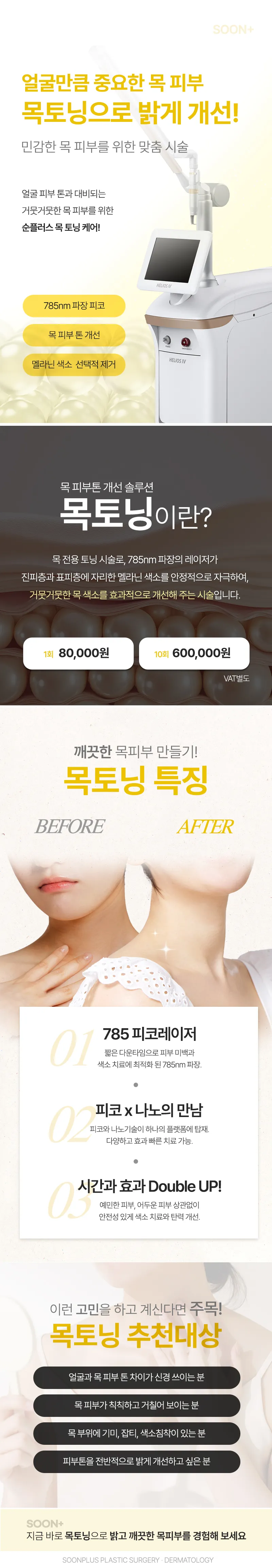 순플러스성형외과 순플러스 목토닝 이벤트, 시술 상세 이미지