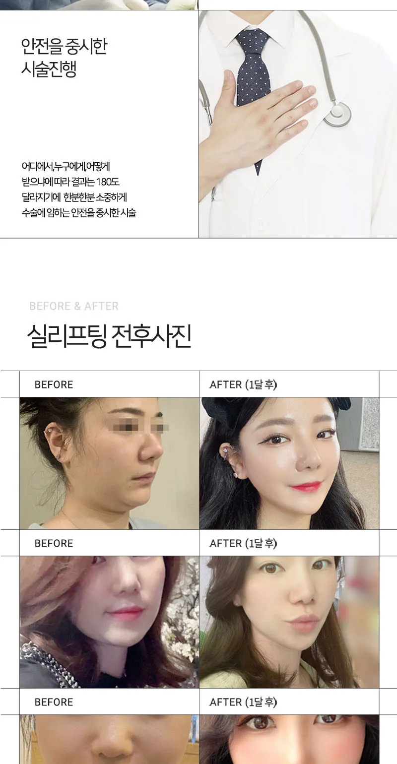 순플러스성형외과 순플러스 집착리프팅_민트실 이벤트, 시술 상세 이미지