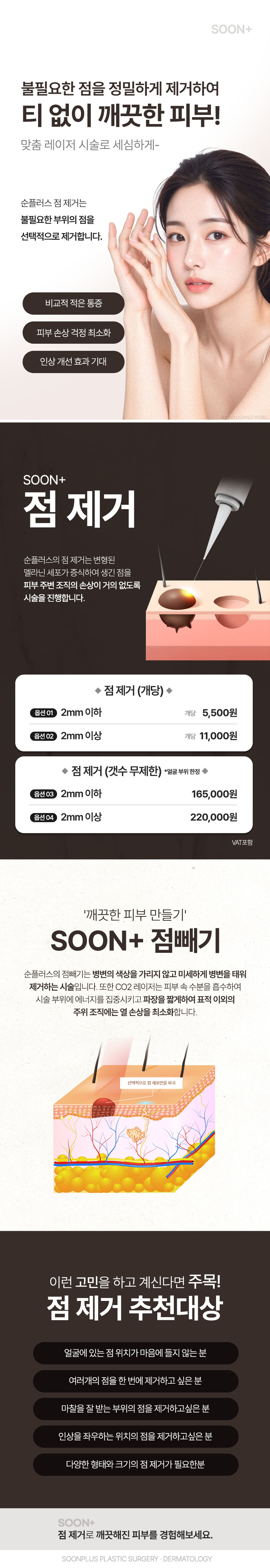 순플러스성형외과 순플러스 점 제거 이벤트, 시술 상세 이미지