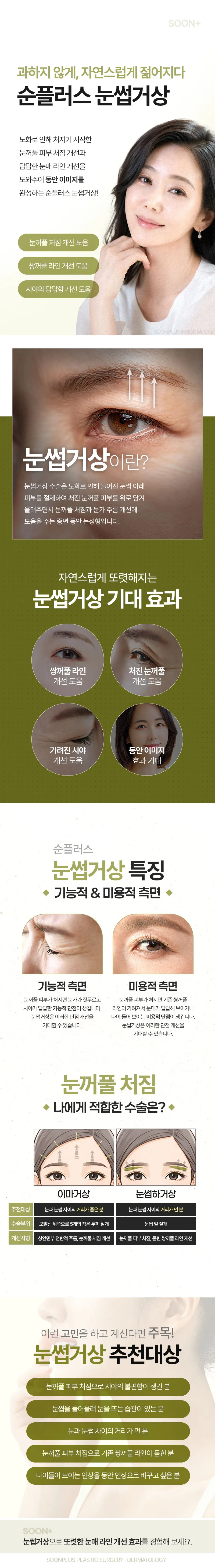 순플러스성형외과 순플러스_눈썹거상_눈썹하거상 이벤트, 시술 상세 이미지