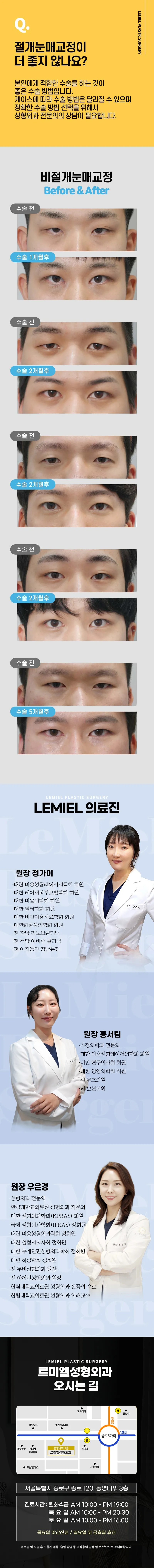 르미엘성형외과의원 3일로끝 남자 비절개눈매교정 이벤트, 시술 상세 이미지