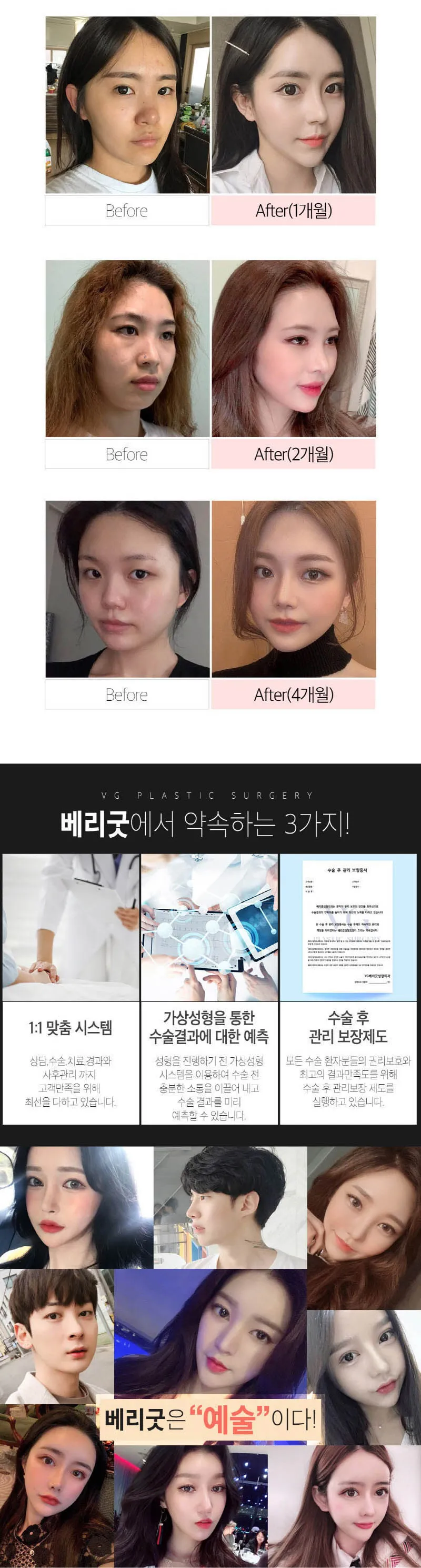 베리굿성형외과의원 베리굿♡기능코성형 이벤트, 시술 상세 이미지