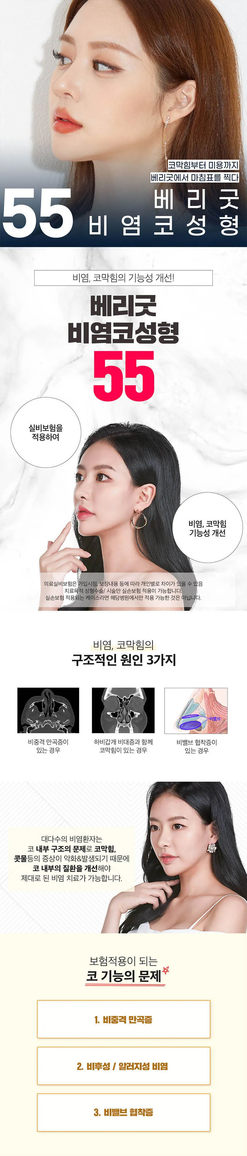 베리굿성형외과의원 베리굿♡기능코성형 이벤트, 시술 상세 이미지