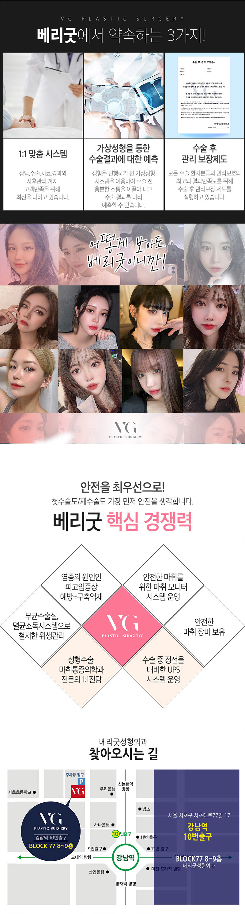 베리굿성형외과의원 베리굿♡절개 눈재수술 이벤트, 시술 상세 이미지