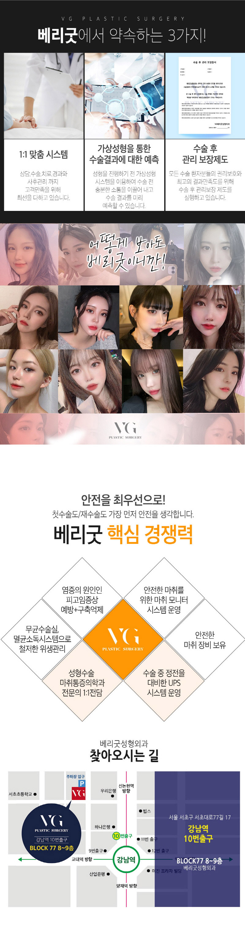 베리굿성형외과의원 베리굿 ♡ 중년 눈성형 이벤트, 시술 상세 이미지