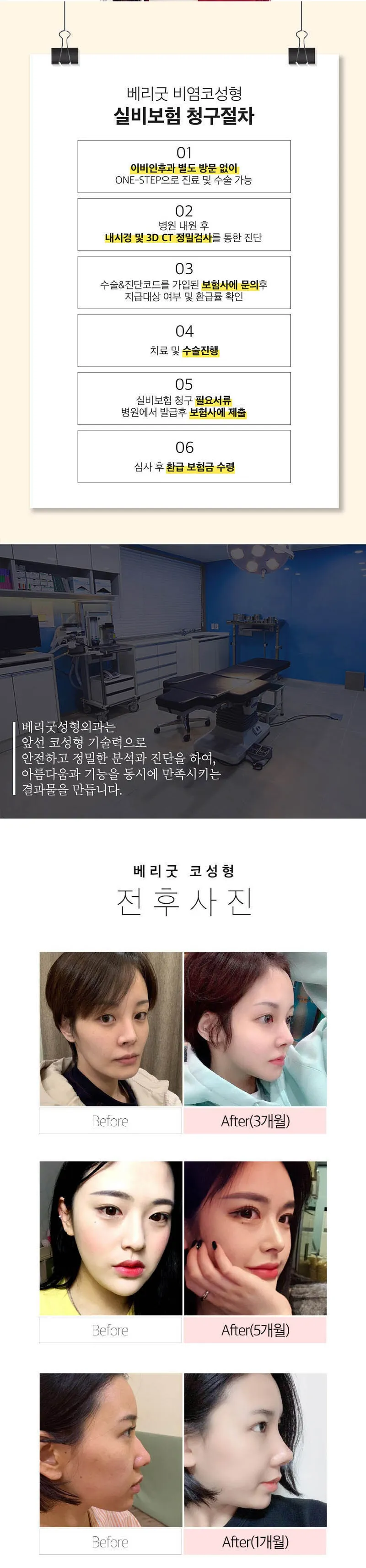 베리굿성형외과의원 베리굿♡기능코성형 이벤트, 시술 상세 이미지