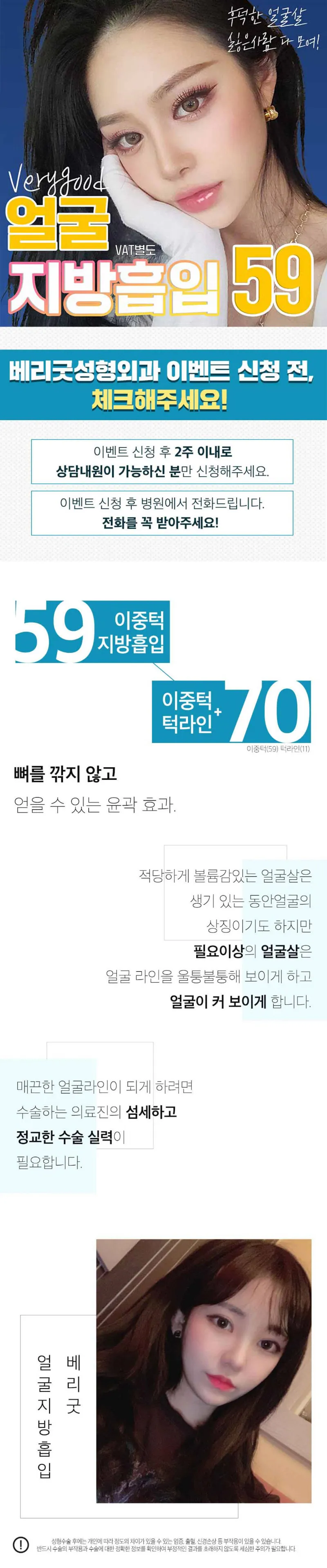 베리굿성형외과의원 베리굿♡얼굴 지방흡입 이벤트, 시술 상세 이미지