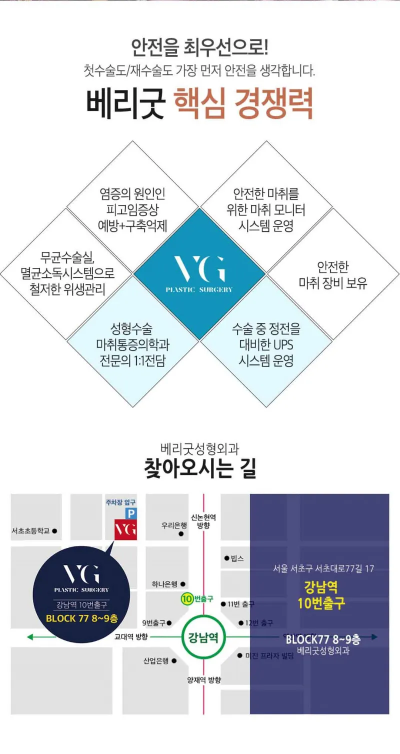 베리굿성형외과의원 베리굿♡얼굴 지방흡입 이벤트, 시술 상세 이미지