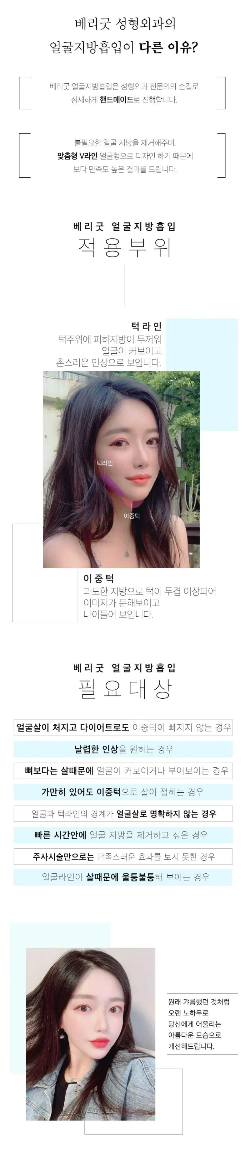 베리굿성형외과의원 베리굿♡얼굴 지방흡입 이벤트, 시술 상세 이미지