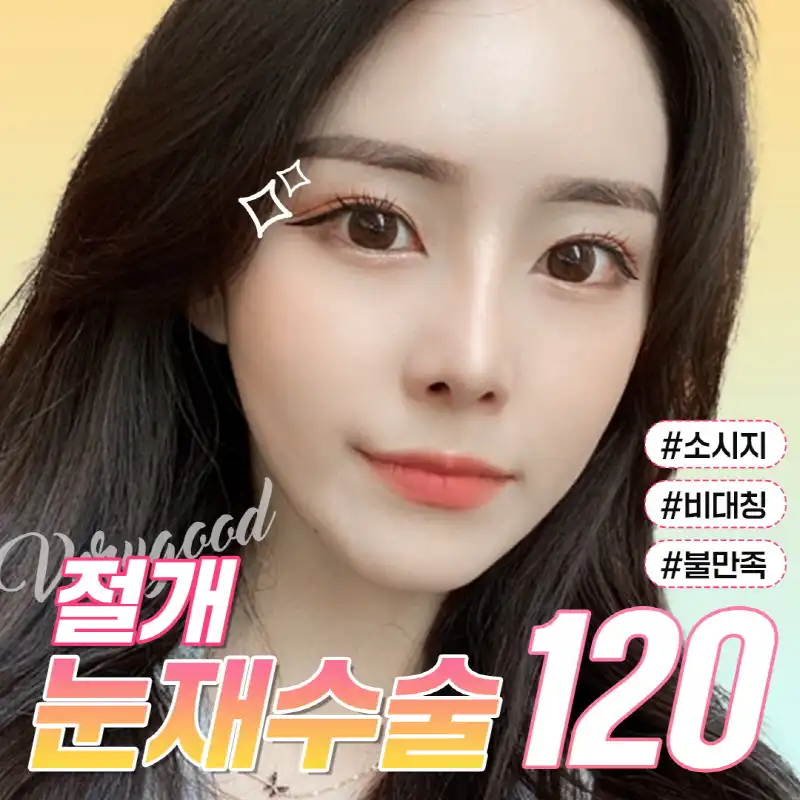 베리굿♡절개 눈재수술