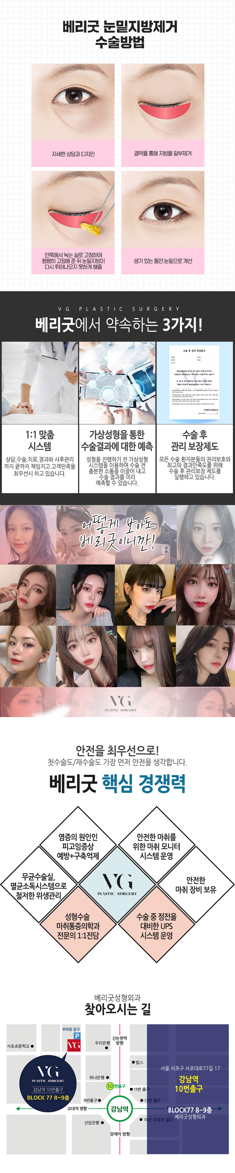 베리굿성형외과의원 베리굿 눈밑지방제거  이벤트, 시술 상세 이미지