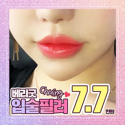 베리굿♡입술필러 이벤트 썸네일 이미지