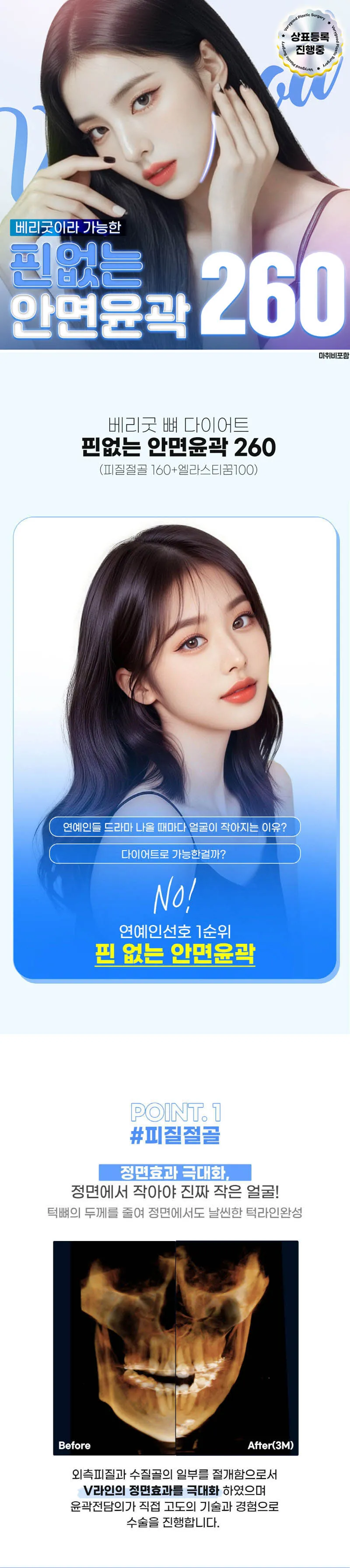 베리굿성형외과의원 핀없는 안면윤곽  이벤트, 시술 상세 이미지