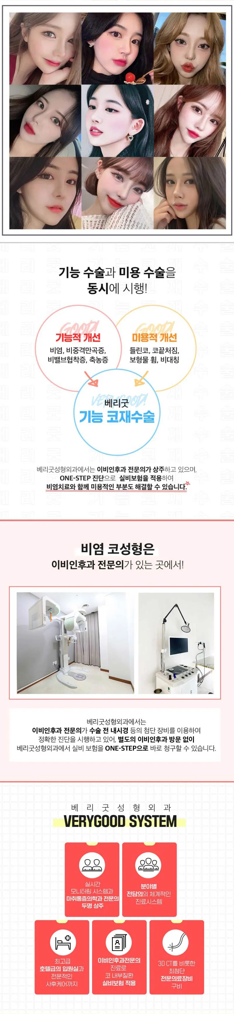 베리굿성형외과의원 베리굿♡코재수술 이벤트, 시술 상세 이미지