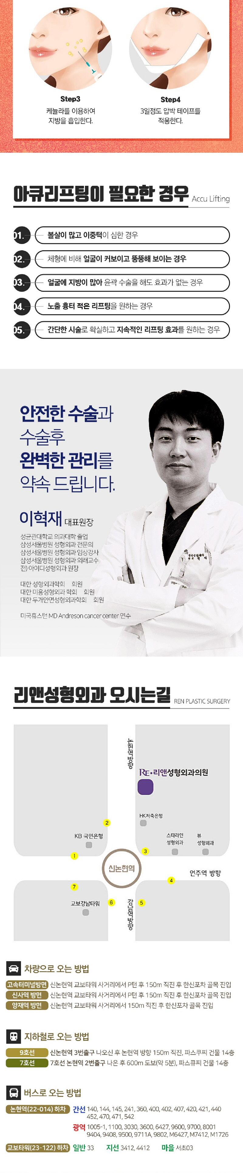 리앤성형외과의원 리앤 얼굴지방흡입 이벤트, 시술 상세 이미지