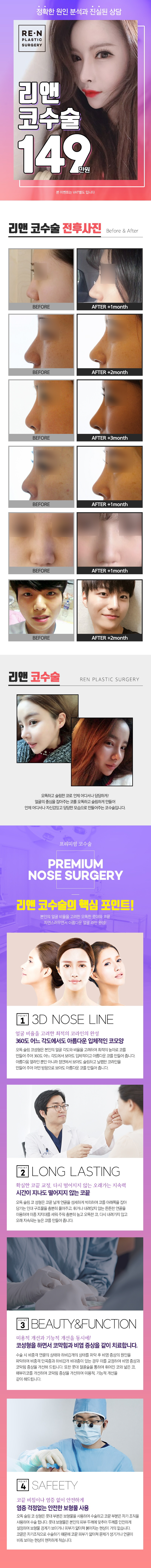 리앤성형외과의원 리앤 코성형  이벤트, 시술 상세 이미지