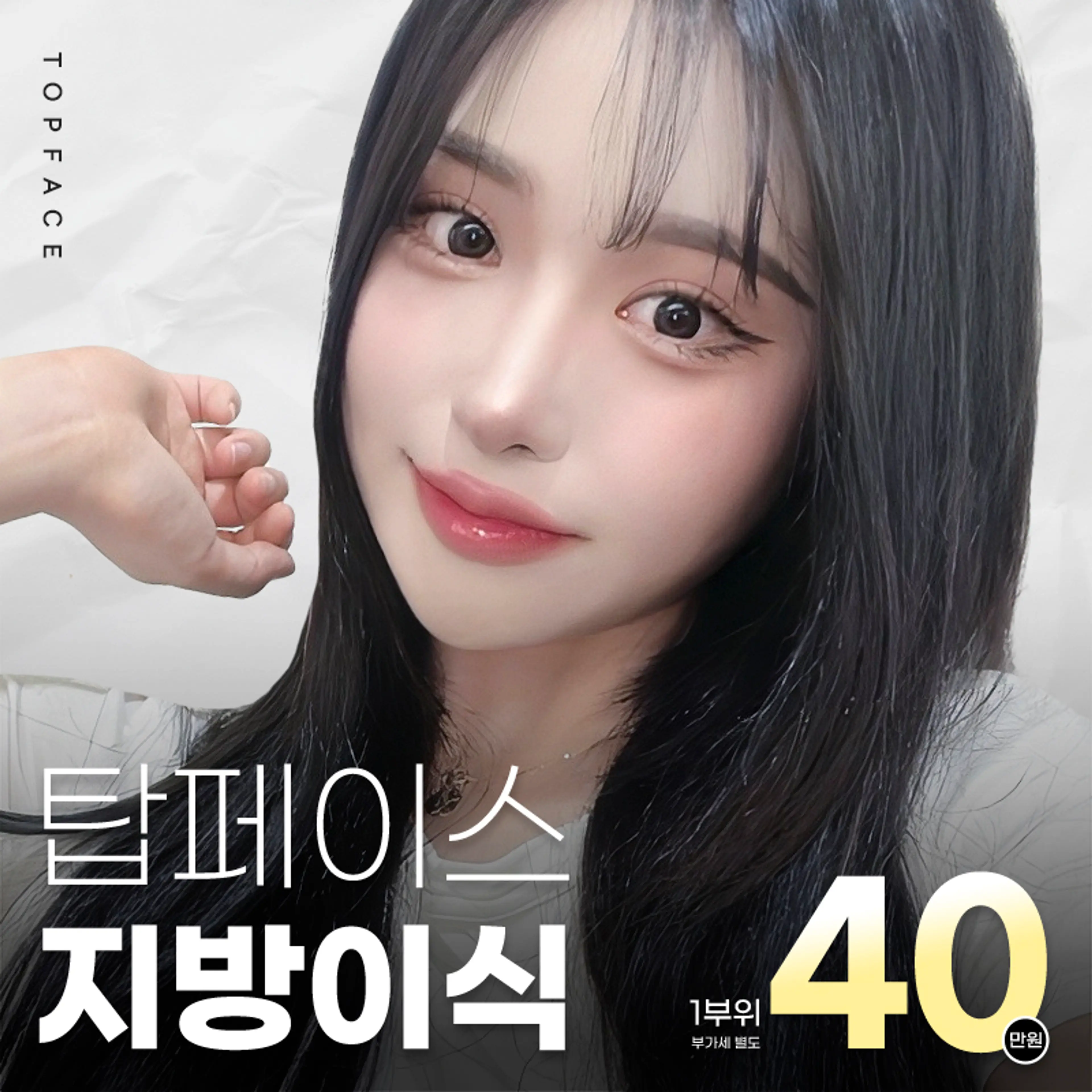 탑페이스 #지방이식