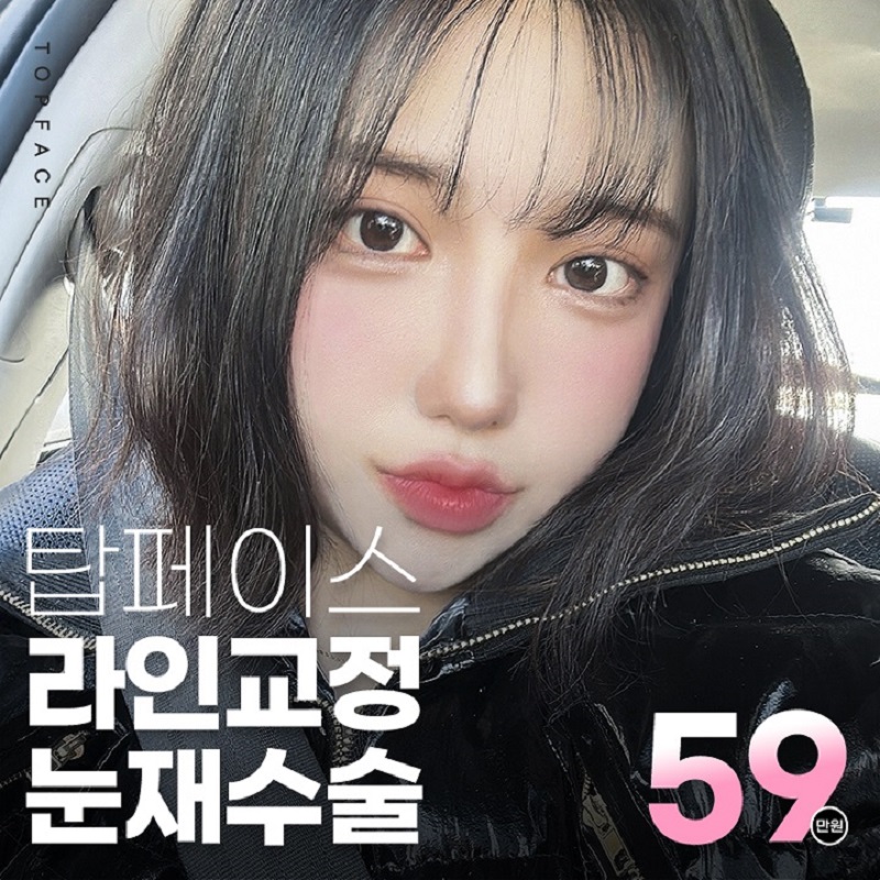 탑페이스➰#눈재수술 이벤트 썸네일 이미지