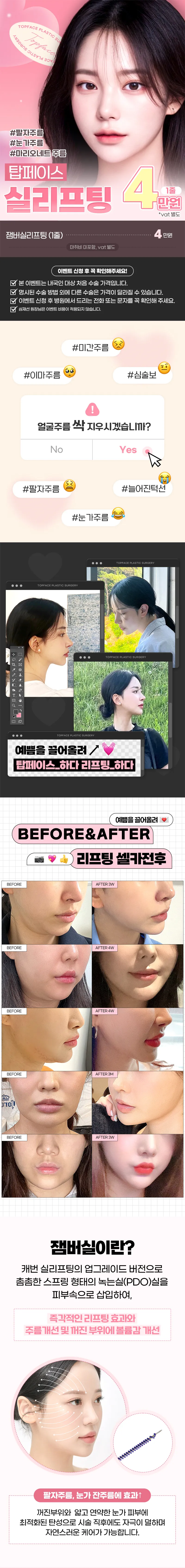 탑페이스 #잼버 실리프팅😎