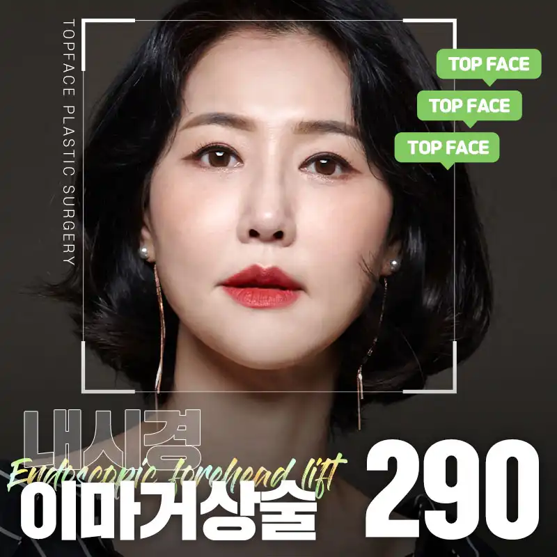 탑페이스 내시경이마거상술