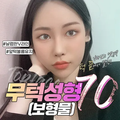 #무턱보형물💖턱끝자신감 이벤트 썸네일 이미지