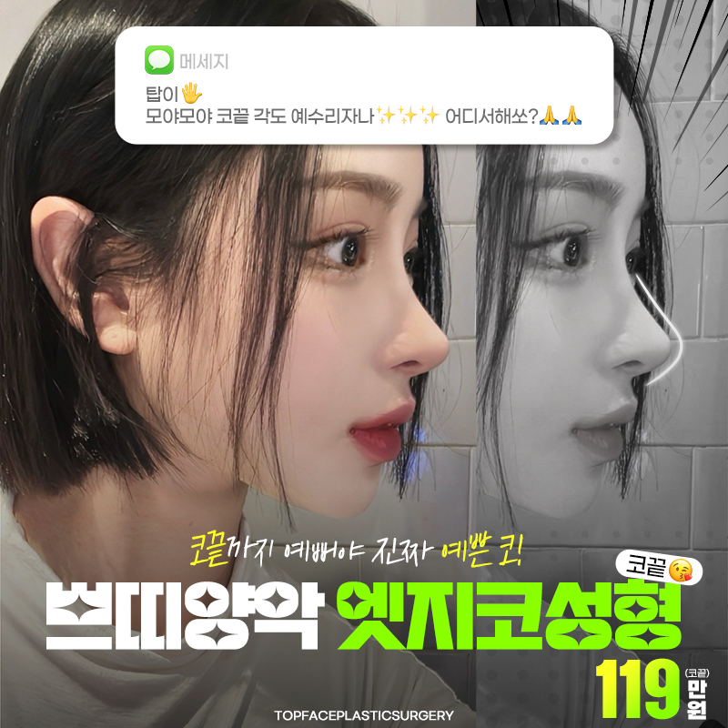 #탑페이스💖엣지코성형 이벤트 썸네일 이미지