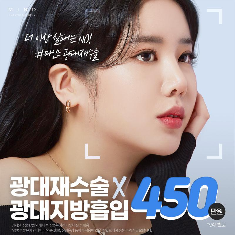 [마인드] 광대재수술 이벤트 썸네일 이미지