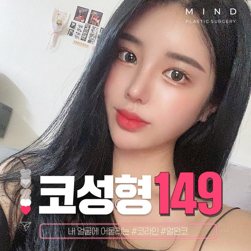 [마인드] 여신코성형 이벤트 썸네일 이미지