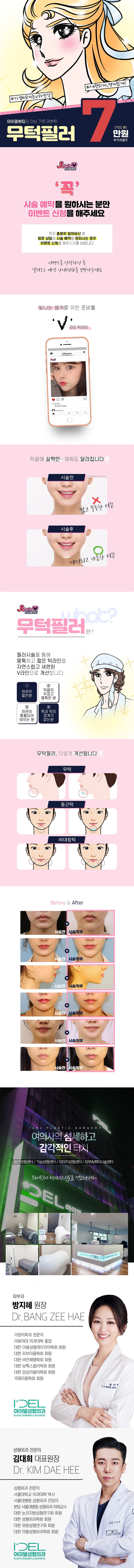 아이델성형외과의원 ♥아이델 무턱필러♥ 이벤트, 시술 상세 이미지