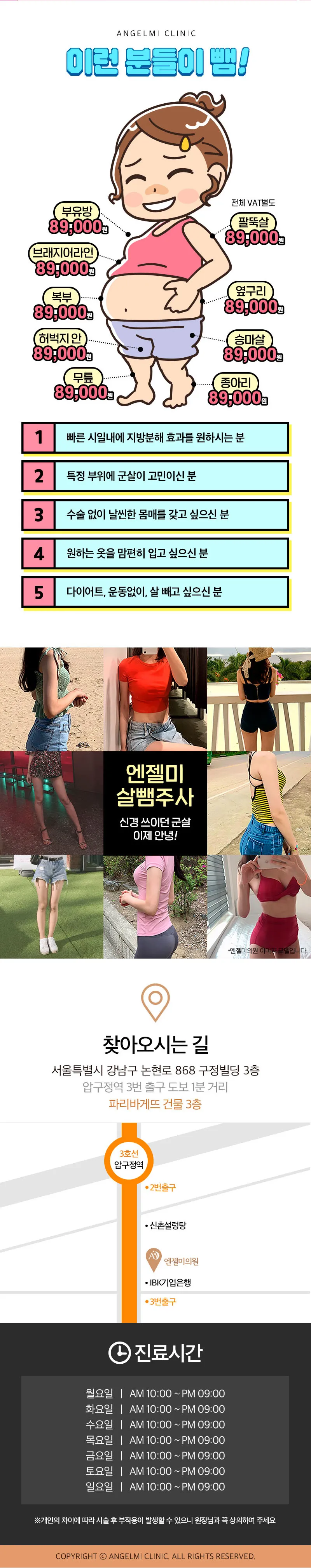 엔젤미의원 살뺌주사 대용량 이벤트, 시술 상세 이미지