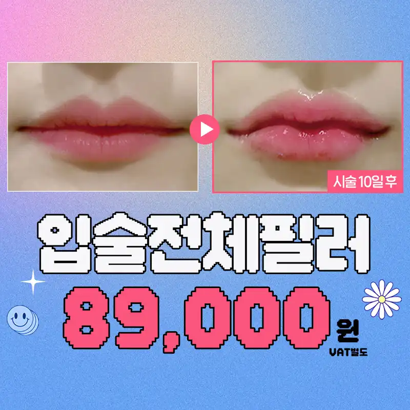 입술전체필러