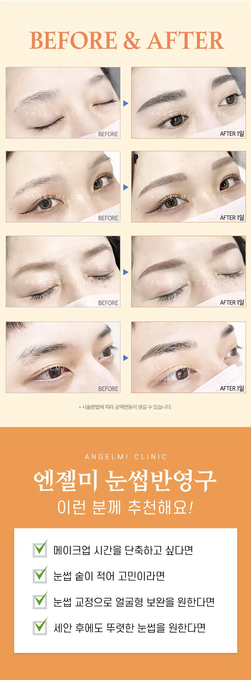 엔젤미의원 연예인 눈썹반영구 이벤트, 시술 상세 이미지