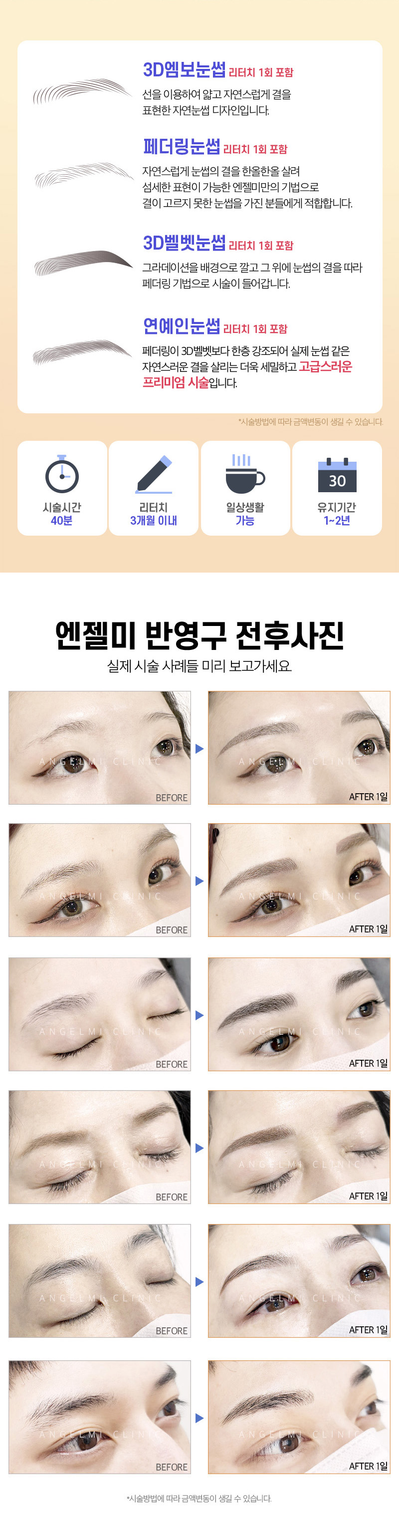 엔젤미의원 눈썹반영구 리터치포함 이벤트, 시술 상세 이미지