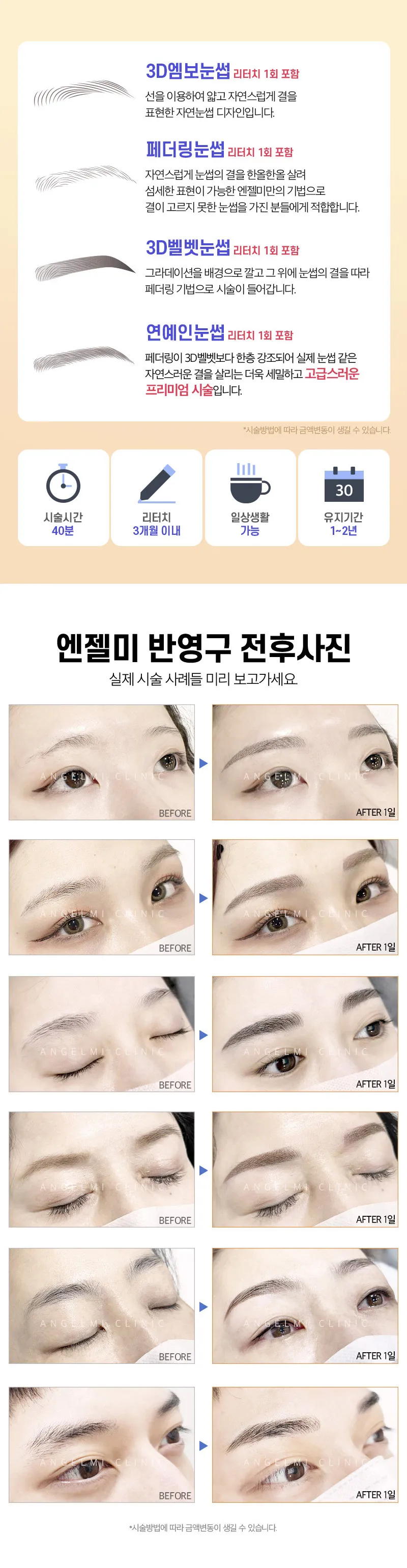 엔젤미의원 눈썹반영구 리터치포함 이벤트, 시술 상세 이미지