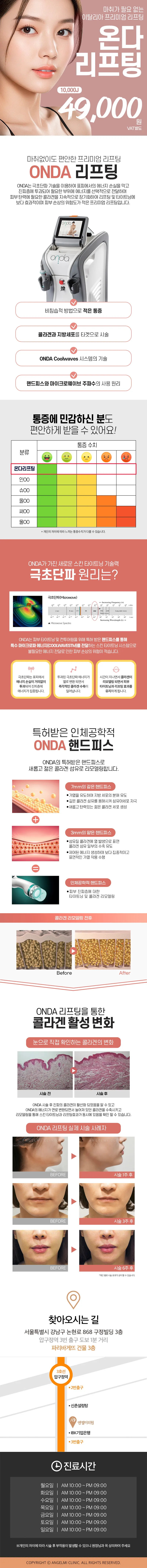 엔젤미의원 온다리프팅 이벤트, 시술 상세 이미지