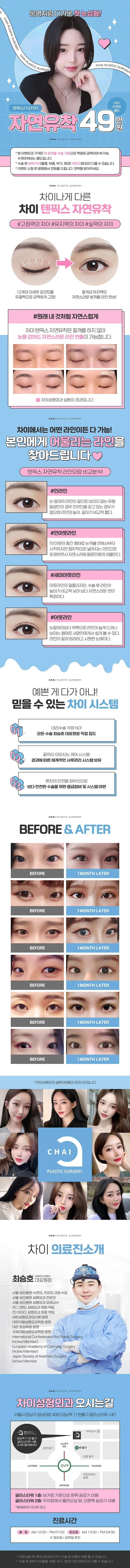 차이성형외과의원 차이 텐픽스 자연유착 이벤트, 시술 상세 이미지