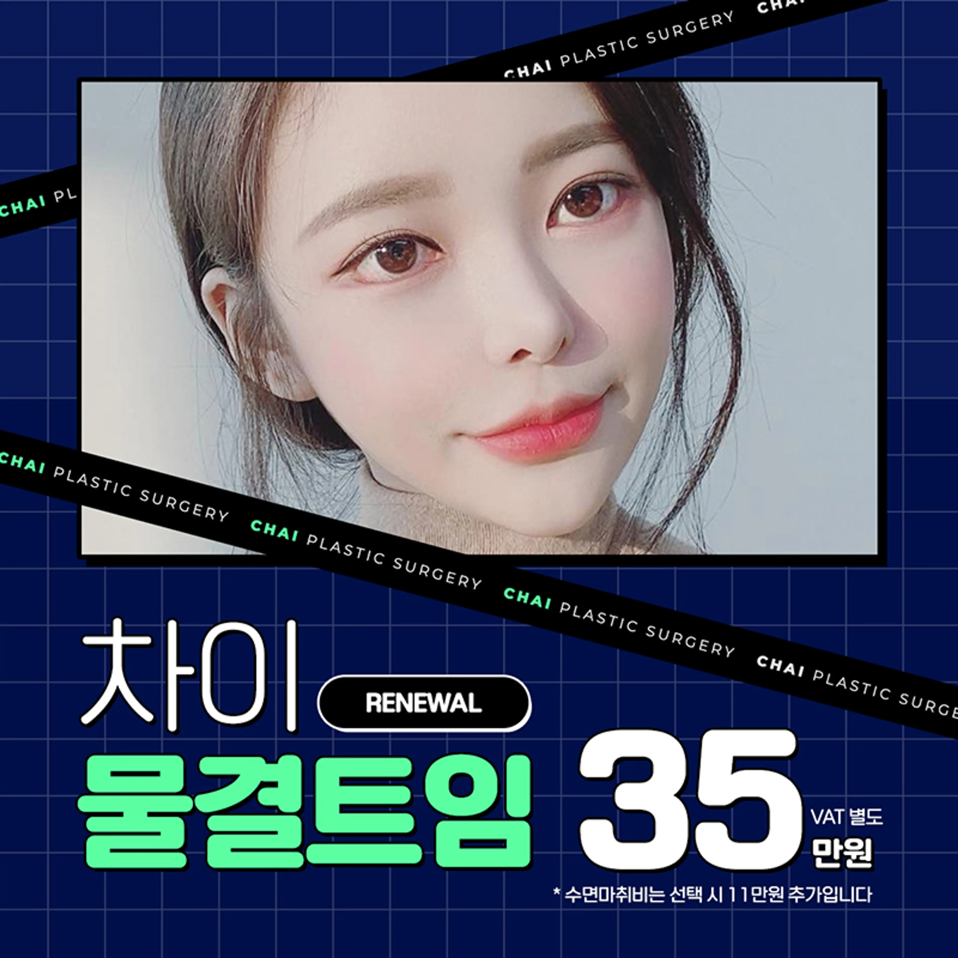 차이 물결트임 35만원♥