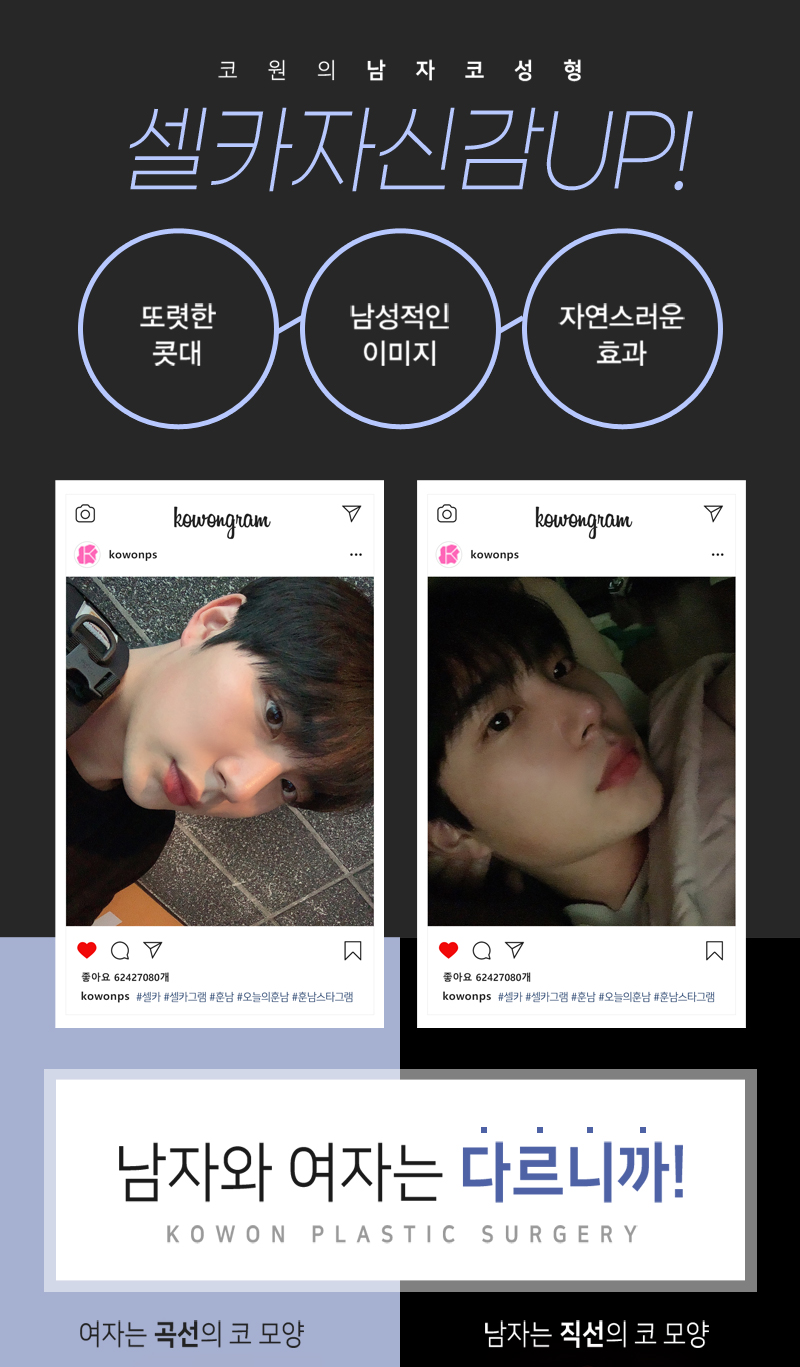 코원성형외과 남자 기능코 성형  이벤트, 시술 상세 이미지