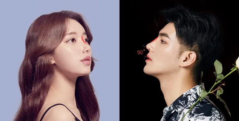 코원성형외과 남자 기능코 성형  이벤트, 시술 상세 이미지