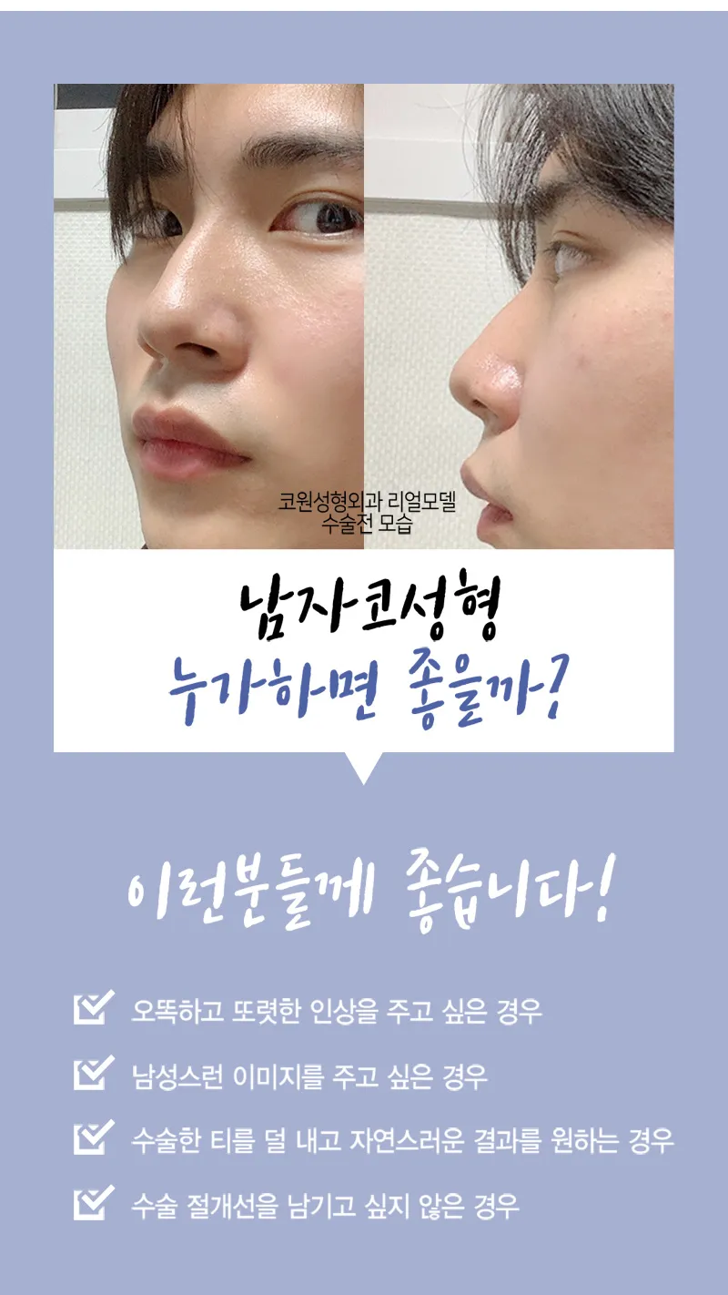 코원성형외과 남자 기능코 성형  이벤트, 시술 상세 이미지