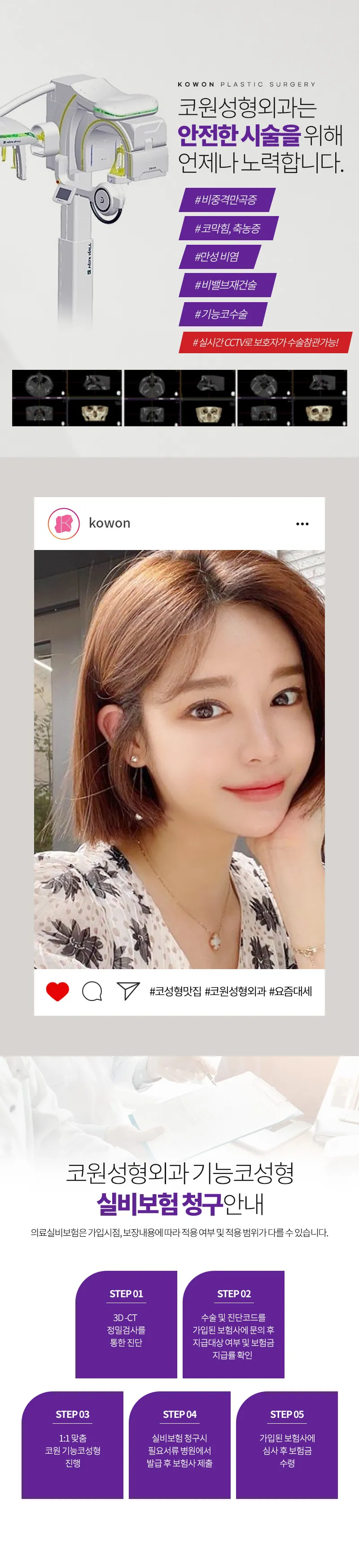 코원성형외과 ★코원 기능코 성형★ 이벤트, 시술 상세 이미지