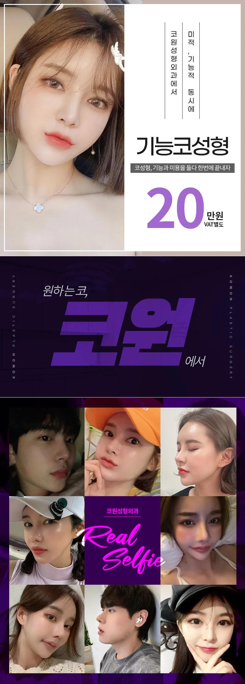 코원성형외과 ★코원 기능코 성형★ 이벤트, 시술 상세 이미지