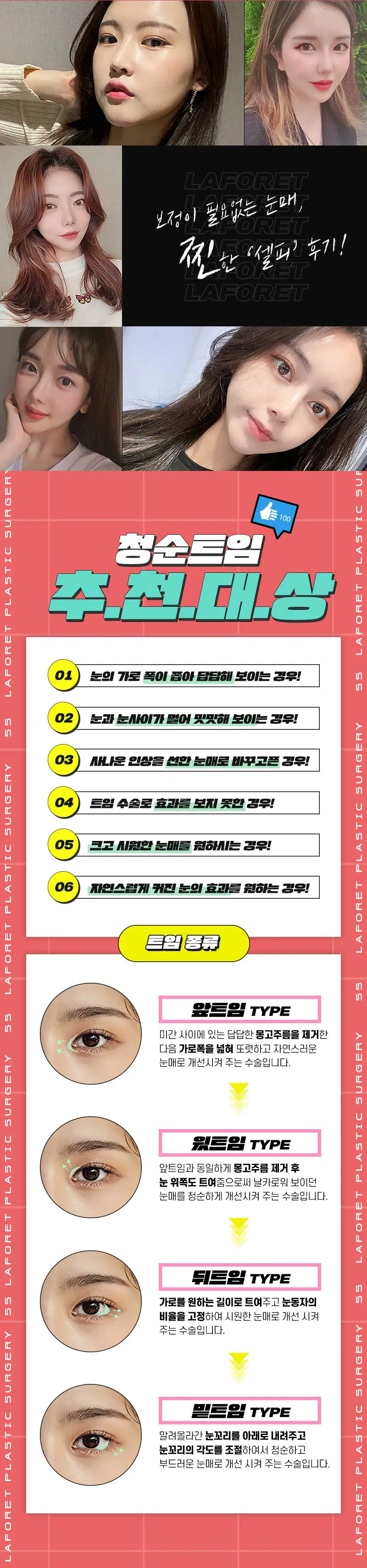 라포레성형외과 한듯안한듯 눈매로! 청순트임 이벤트, 시술 상세 이미지
