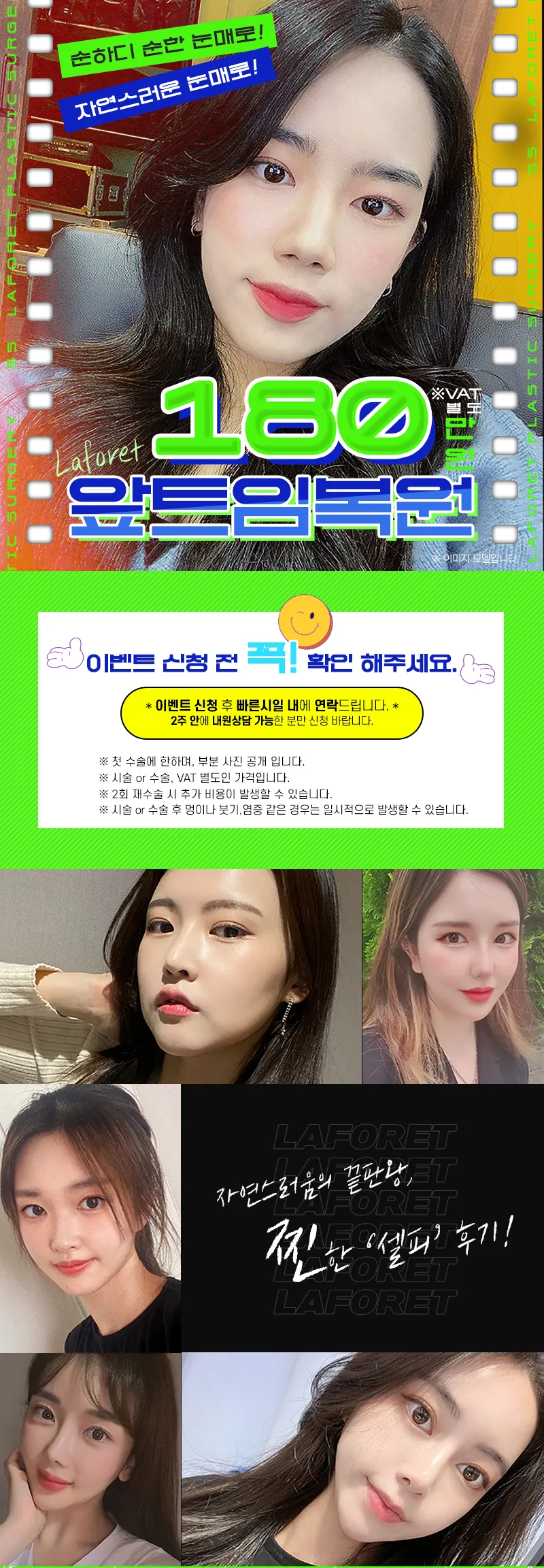 라포레성형외과 1mm의 차이, 앞트임복원 이벤트, 시술 상세 이미지