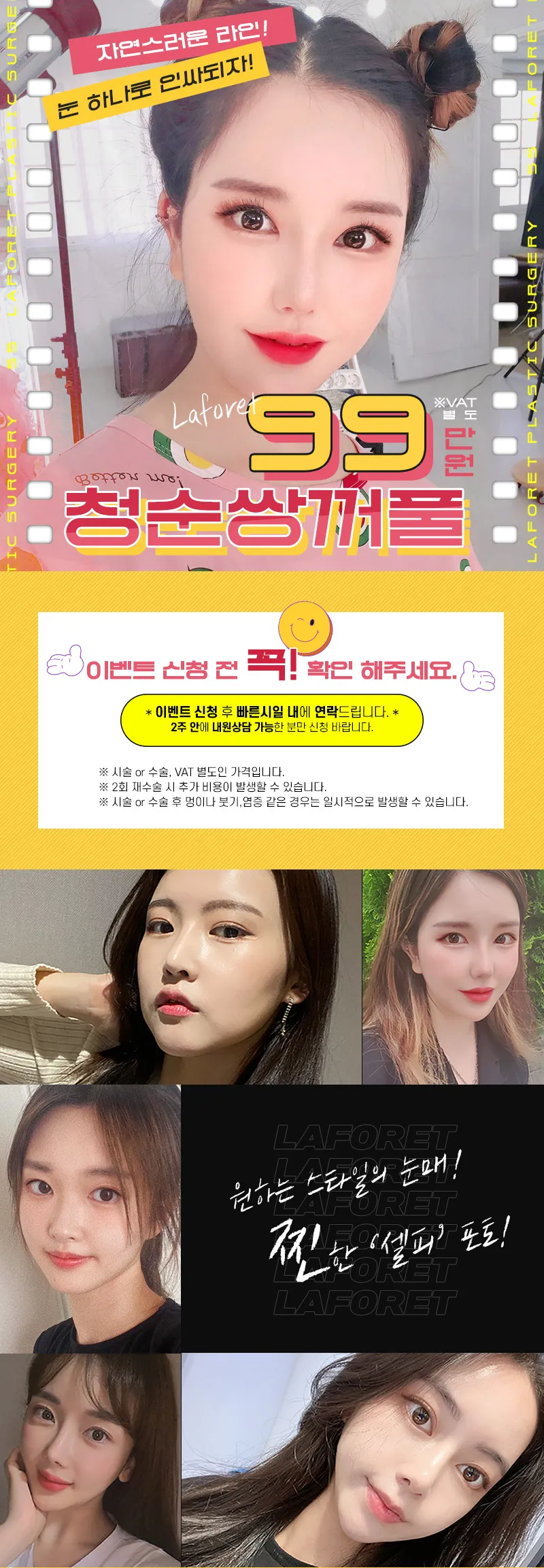 라포레성형외과 자연스러운 라인! 청순쌍꺼풀 이벤트, 시술 상세 이미지