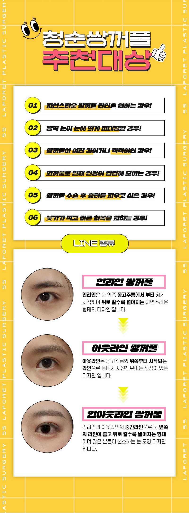 라포레성형외과 자연스러운 라인! 청순쌍꺼풀 이벤트, 시술 상세 이미지