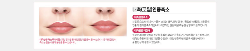 에이치비성형외과의원 흉터 걱정을 줄인 이상적인 인중성형 이벤트, 시술 상세 이미지