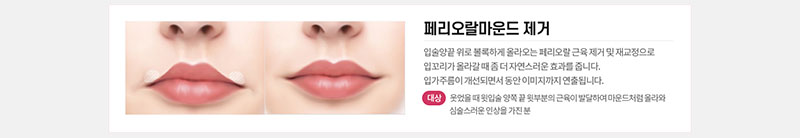 에이치비성형외과의원 흉터 걱정을 줄인 이상적인 인중성형 이벤트, 시술 상세 이미지